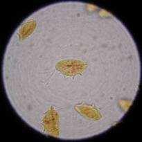 Trichomoniasis Protozoa,
