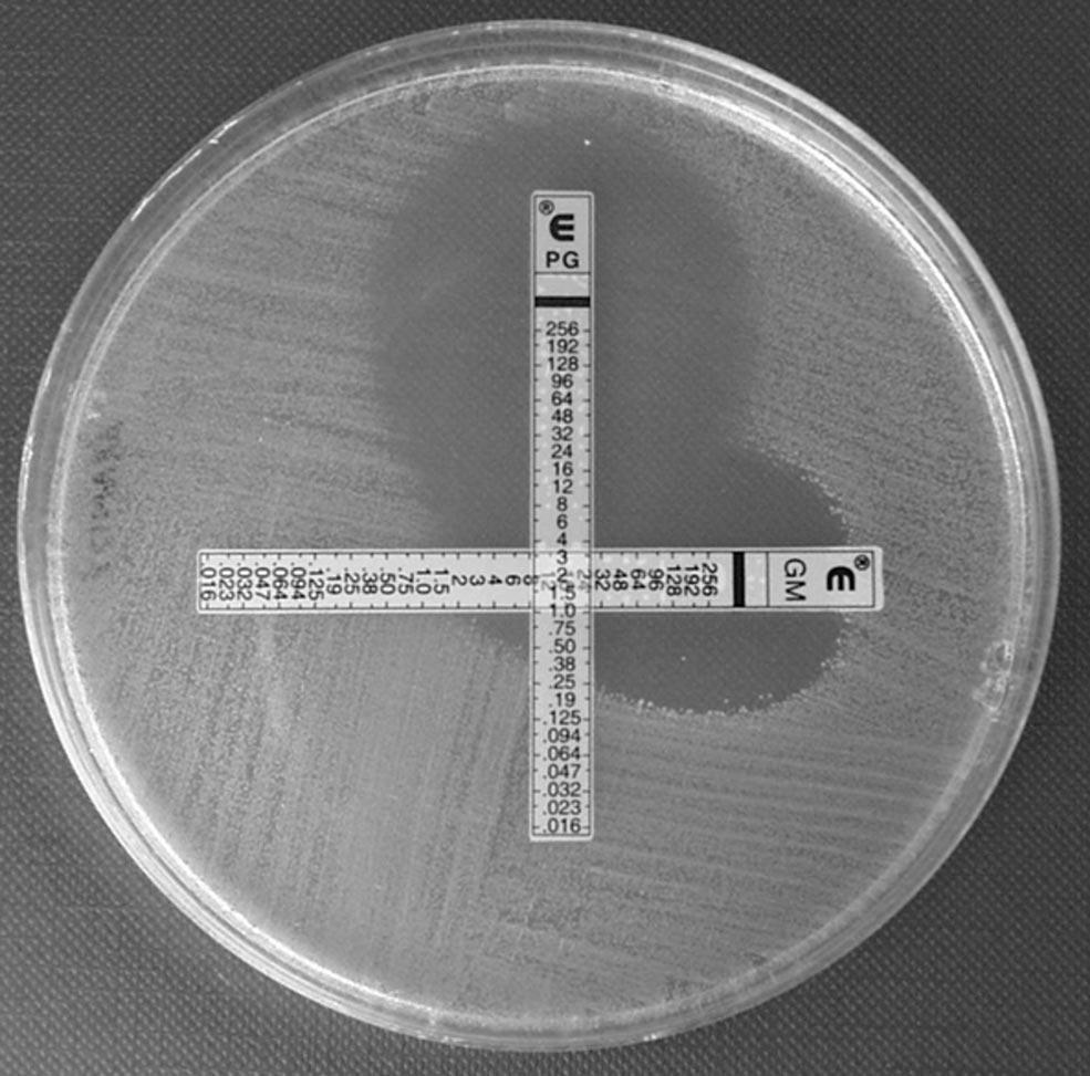 4154 Sueke et al. IOVS, August 2010, Vol. 51, No. 8 FIGURE 3. Photograph of an E-test combination experiment between gentamicin and penicillin against fecal streptococci, demonstrating additivity.