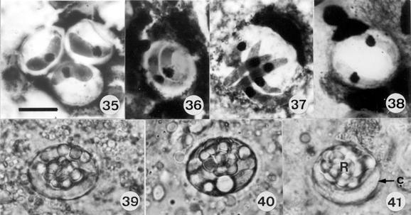 110 Life-cycle of Hepatozoon caimani Ralph Lainson et al. Figs 35-41: resting cystic stages of Hepatozoon caimani in a variety of experimental secondary vertebrate hosts.