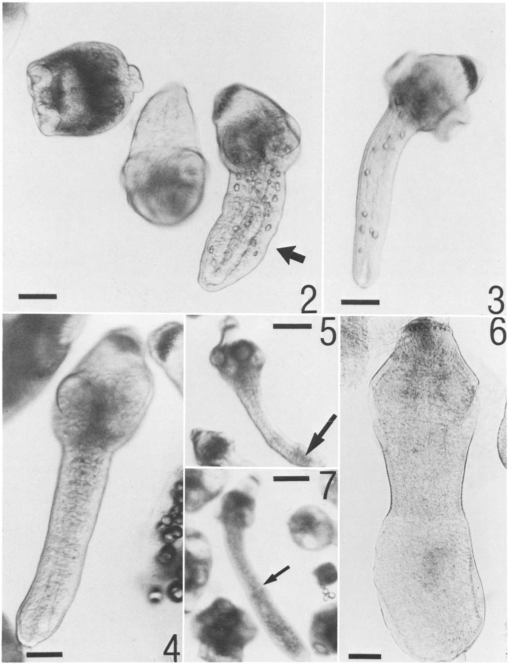 /I 242 THE JOURNAL OF PARASITOLOGY, VOL. 76, NO. 2, APRIL 1990 / /l 2-3 ''rt N., 4 / I t. /'. /.. %K -11 m FIGURES 2-7. Stages of development of Echinococcus multilocularis in vitro. 2. Day 4, showing evaginated, vermiform stage (arrow) and unevaginated form on the far left.