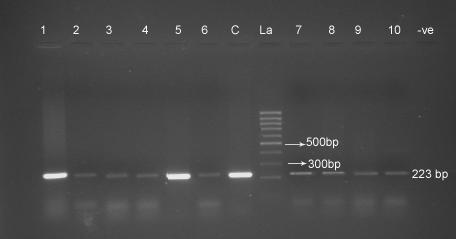 Figure 1. Agarose gel showing PCR amplification product (223 bp) for BCSP31 gene using primer pair B4/B5 of Brucella.