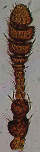 Trogoderma granarium: (A), (D) male antenna