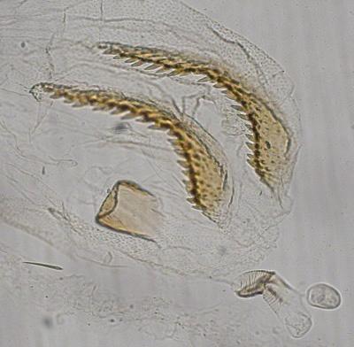 from the bursa copulatrix of female genitalia