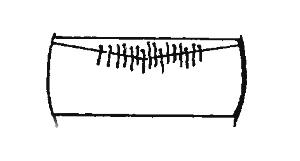 Figure 19: Abdominal tergite and setae: (A) abdominal tergite of Trogoderma variabile larva with enlarged hastiseta; (B) first