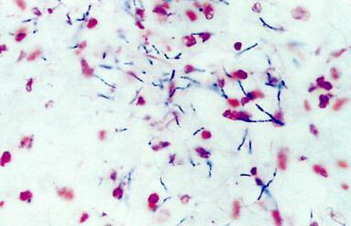 Nocardia spp. Pyogranulomatous suppurative infections Ubiquitous saprophytes (soil, decaying veg, compost, animal feces) N.