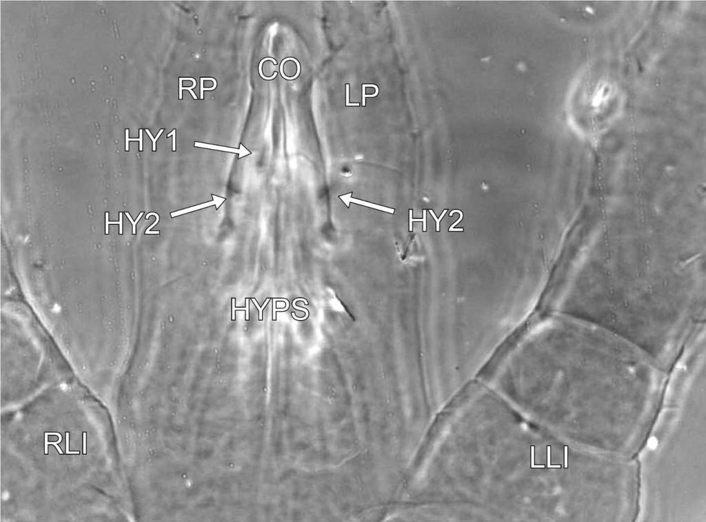 (RCH), tiny fixed digit of chelicera (FDCH, left), elongate movable digit of chelicera (MDCH, left and right) with denticles (DE), left palp (LP), and right palp