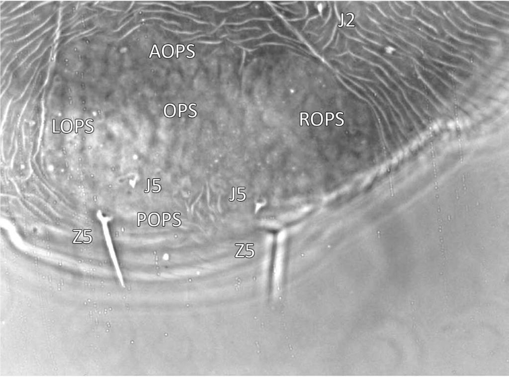 Acarologia 52(1): 59 86 (2012) FIGURE 14: Prasadiseius cocytes (protonymph) Dorsal view of posterior idiosoma (ID) showing opisthonotal shield (OPS) having concavity and convexities in anterior
