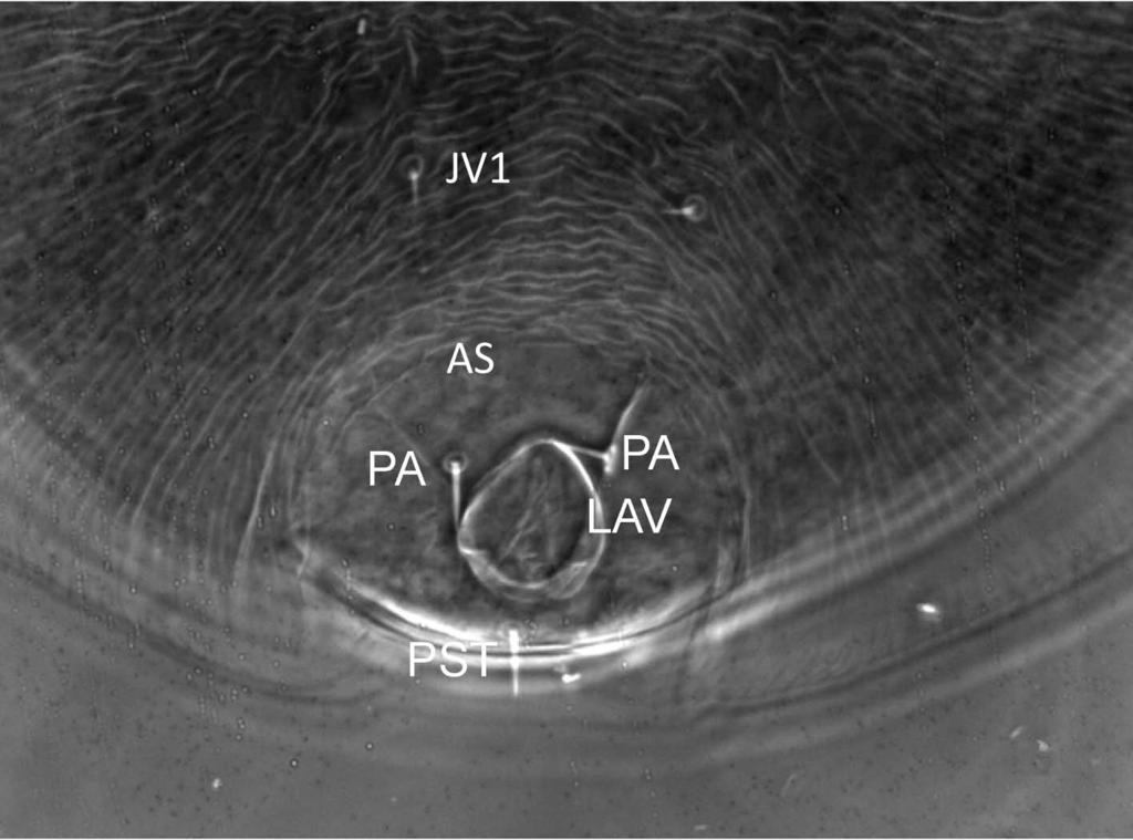 setae ST1, ST2, and ST3 located marginally on the shield, anterior lateral concavity (LCONC-1) near coxa II (LCII) in between ST1-ST2, posterior lateral concavity (LCONC-2) near coxa III
