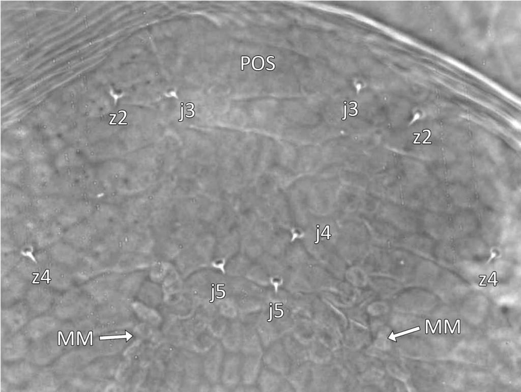 Acarologia 52(1): 59 86 (2012) FIGURE 23: Prasadiseius cocytes (deutonymph) Dorsal view of anterior idiosoma (ID)