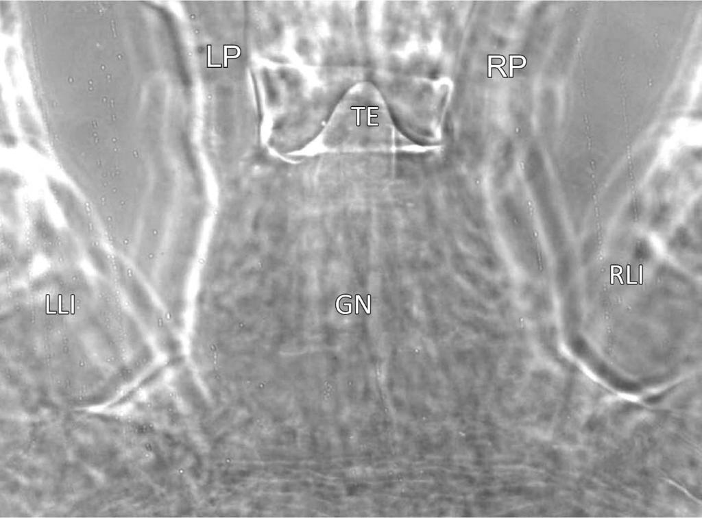 Note longer movable digit with more denticles than in protonymph (Fig. 17) (VP10-36-31, 400x).