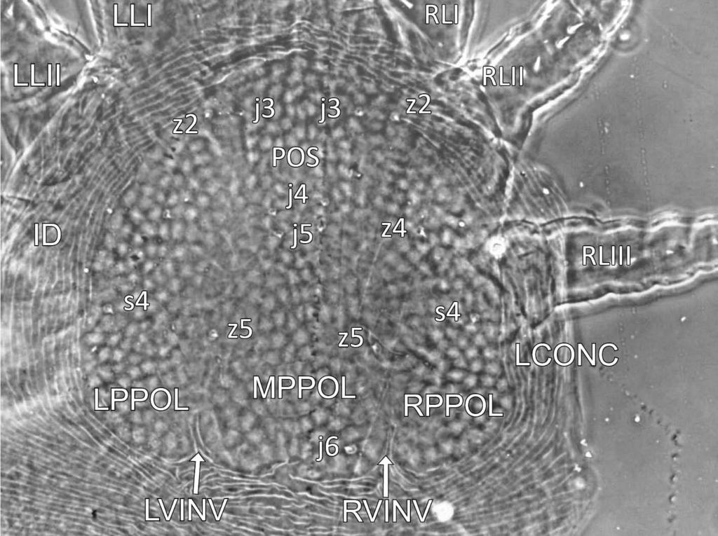 Acarologia 52(1): 59 86 (2012) FIGURE 3: Prasadiseius cocytes (larva) Dorsal view of anterior idiosoma (ID) showing parts of 3 pairs of right legs (RLI-RLIII), 2 pairs of left legs (LLI-LLII),