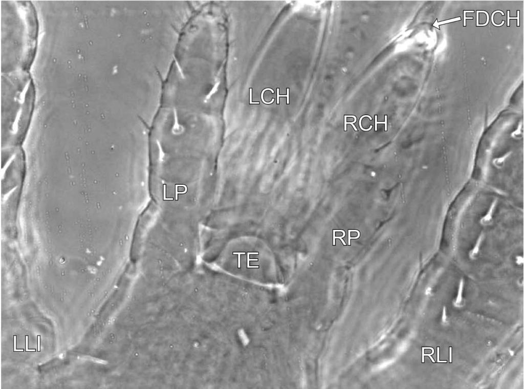 FIGURE 8: Prasadiseius cocytes (larva) Dorsal view of gnathosoma (GN) in between left leg I (LLI) and right leg I (RL1) with tectum