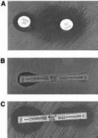 Antibiogram profiles ESBL non-esbl Alteration of porin channels in bacterial cell wall, reducing permeability Carbapenemase production MIC 1 2 3 4 Cephem MIC 1 2 3 4 Cephem 87 Serine