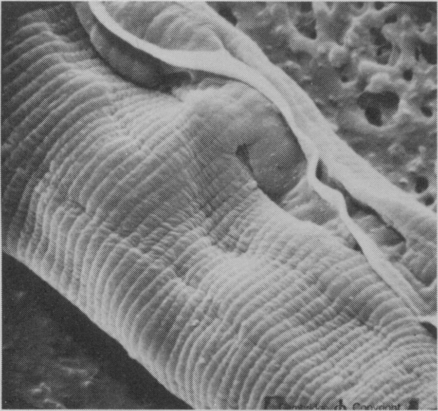 canis larvae with the scanning electron microscope, and they demonstrate well the chitinous mouth parts and the alae, or wings, with which the larva is equipped.
