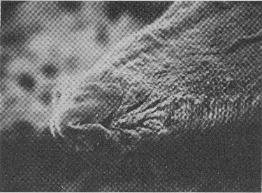 granulomata. They have been demonstrated in the liver by Beaver (1952) and in one case in Dr. Avery Jones's unit in London.