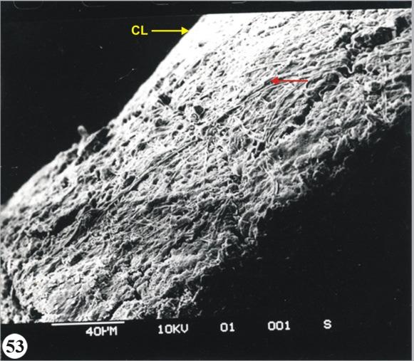 Figure 7 : Radial view of shell membrane showing thick fibrous structure. Figure 8: Radial view of shell membrane showing fibres coated with thin film of unknown substance (Arrow).