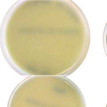 0 (86-99) 100 (98-100) 100 (98-100) 82.5 (77-86) ChromID MRSA 58.0 (43-71) 88.0 (75-95) 96.0 (86-99) 100 (98-100) 99.7 (98-99) 98.7 (96-99) MRSA, methicillin-resistant Staphylococcus aureus.