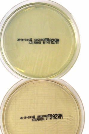 True-positive results were defined as the appearance of typically colored colonies on at least 1 of the chromogenic media that, on isolation, contained catalase-positive, Staphaurex agglutination