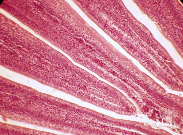 Fig. 1: Photomicrograph showing leaf-like villi in the duodenum