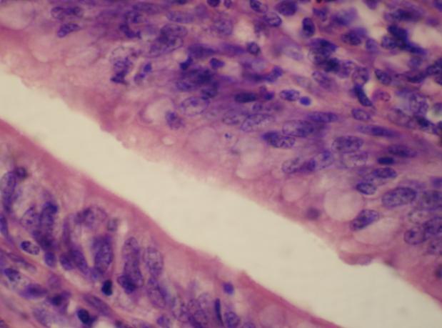 3: Photomicrograph of duodenal villi showing chief cell having
