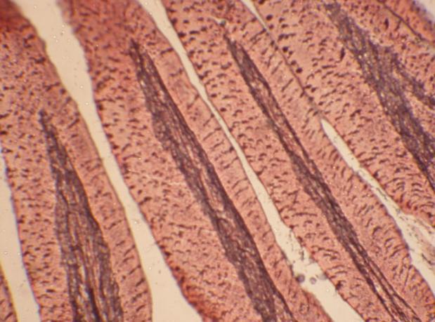 11: Photomicrograph showing sparse distribution of reticular fibers in the