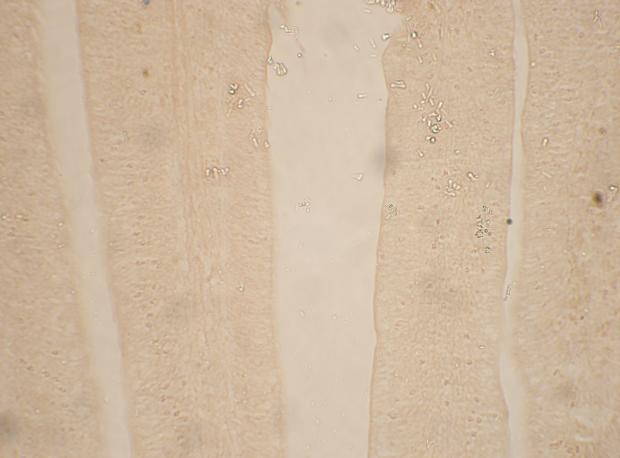 Fig. 25: Photomicrograph showing moderate reaction of acid mucin in the glandular epithelium