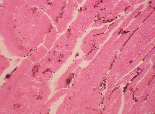 27: Photomicrograph of ileal villous epithelium showing grouping of argentaffin cells in 14 