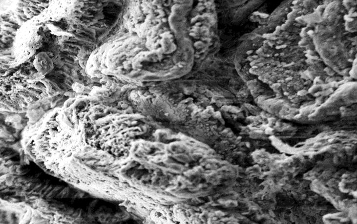 50: Scanning electron micrograph of duodenal villi in day 1 chick showing a smooth lateral surface