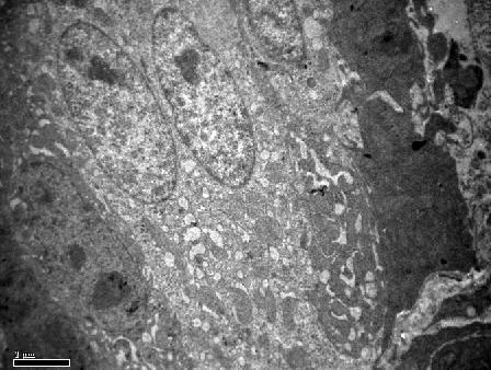 60: Transmission electron micrograph of duodenum surface epithelium showing chief