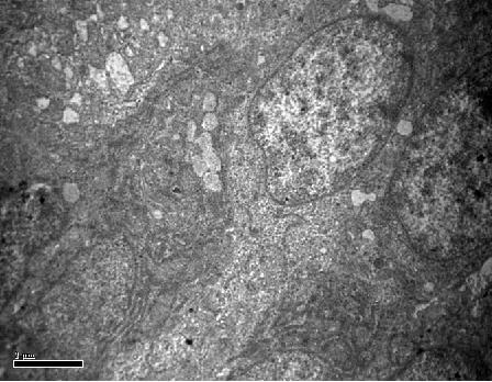 mitochondria in the vicinity of the nucleus and discrete rough endoplasmic reticulum (Rer) in 28 day old chick (X13300)