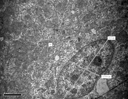 GM GM Fig. 65: Transmission electron micrograph of duodenum surface epithelium in 28 days old chick.