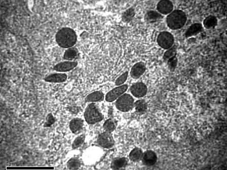 70: Transmission electron micrograph of a mast cell (MC) in the lamina propria of duodenum in day 28 old