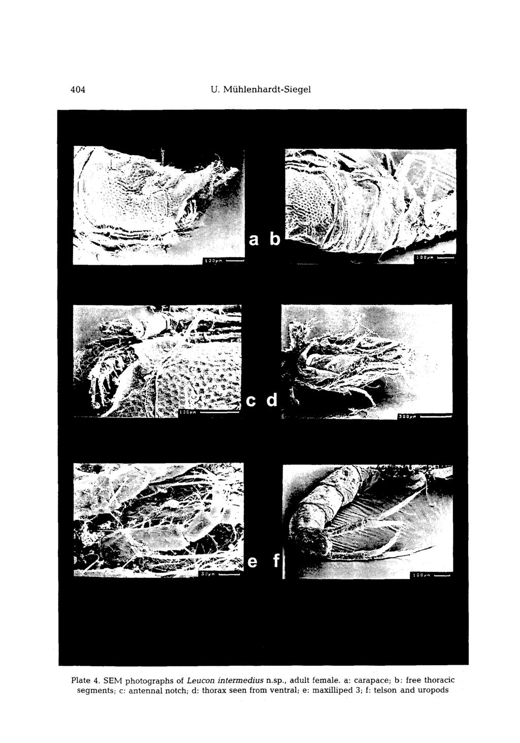404 U. Mfihlenhardt-Siegel Plate 4. SEM photographs of LeuCon intermedius n.sp.