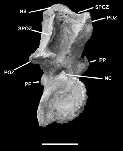 & A.W.A.KELLNER Pleurocoels are absent in all elements of the series, a feature observed in Malawisaurus dixeyi and in the sole cervical element known from Gondwanatitan faustoi, respectively from