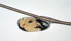 The head louse nit (egg) remains glued to the hair shaft (www.livescience.com) Head lice are especially common on children between the ages of 3 and 10.