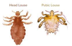Large numbers of children come into close personal contact in day cares and schools, where lice may be transferred directly from infested children.