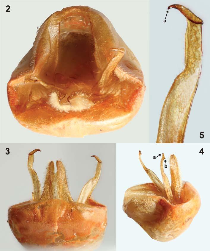 52 STEHLÍK & KMENT: Notes on Antilochus, subgenus Neaeretus (Pyrrhocoridae) Figs. 2 5., holotype, male genitalia.