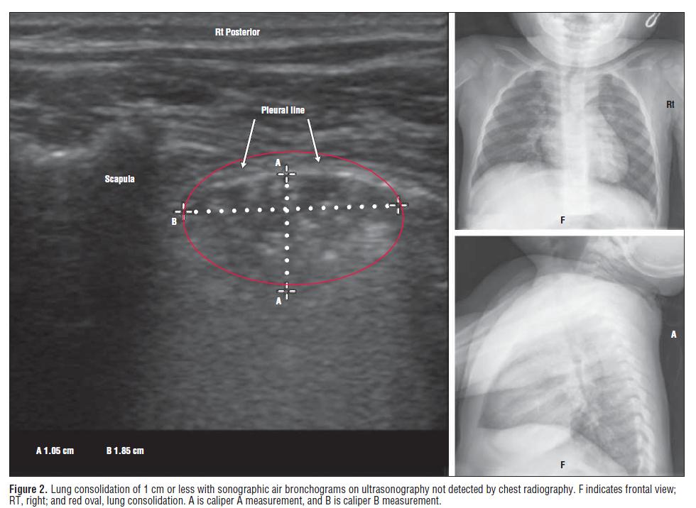 Ultrasonographic diagnostic in children and adults Shah VP et al. JAMA Pediatr. 2013 Feb;167(2):119-25.
