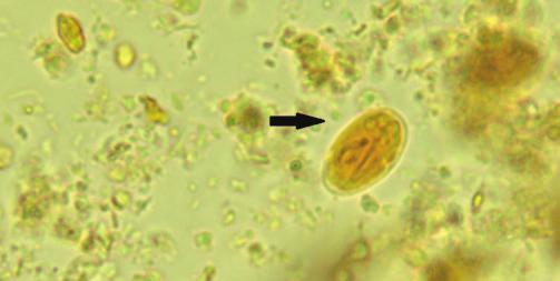 E These organisms were found on fecal flotation from a kitten with diarrhea.