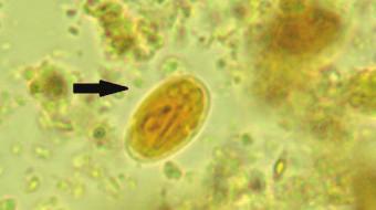7. Cystoisospora species (E) These are oocysts of Cystoisospora felis, the common coccidia of cats. Cystoisospora species are not zoonotic and would not pose any infection risk to the owner.