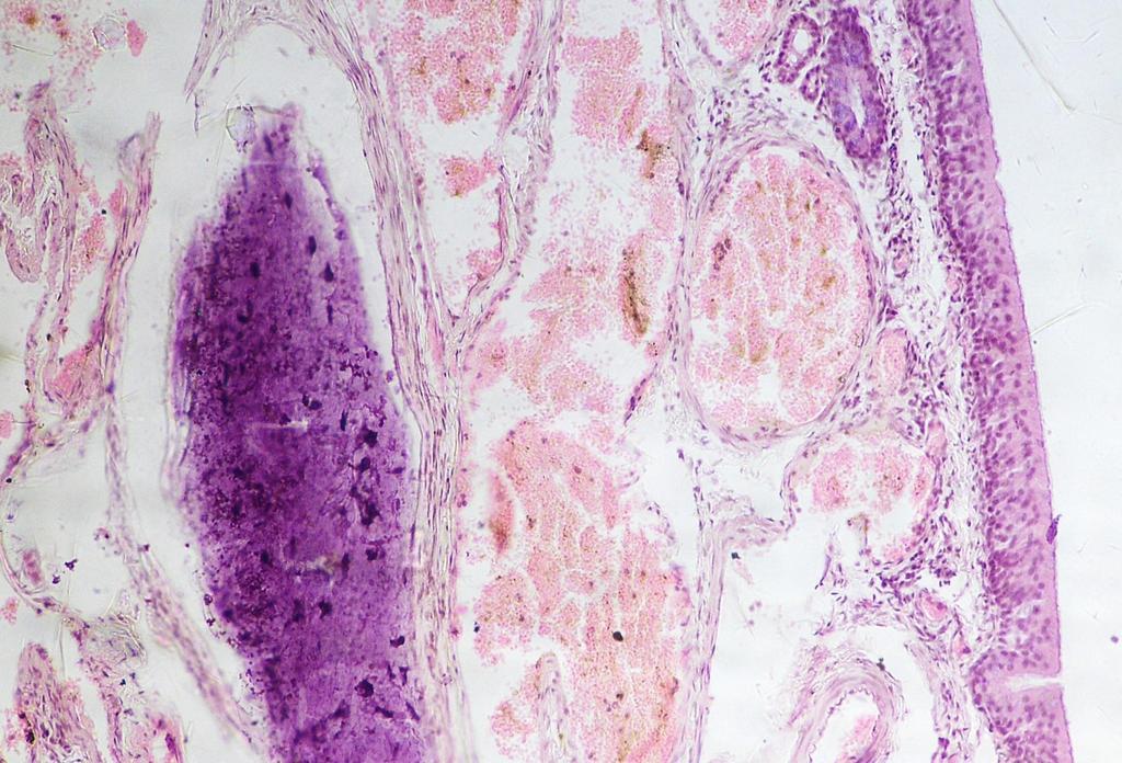 V V V PLATE 2: PHOTOMICROGRAPH OF THE TURBINATE TISSUE FROM SHEEP INFESTED WITH OESTRUS