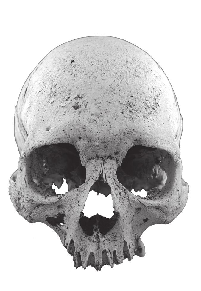 The cranium was found completely buried with the exception of a small section of the right parietal bone, as noted earlier.