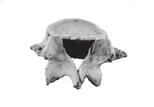 Cleft neural arch was previously documented in an atlas vertebra from NgLj-2 (Keenleyside et al., 1997).