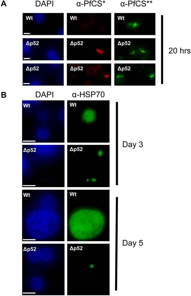 Figure 4. Development of wild-type and Dp52 parasites in primary human hepatocytes. (A) Parasites at 20 hours.