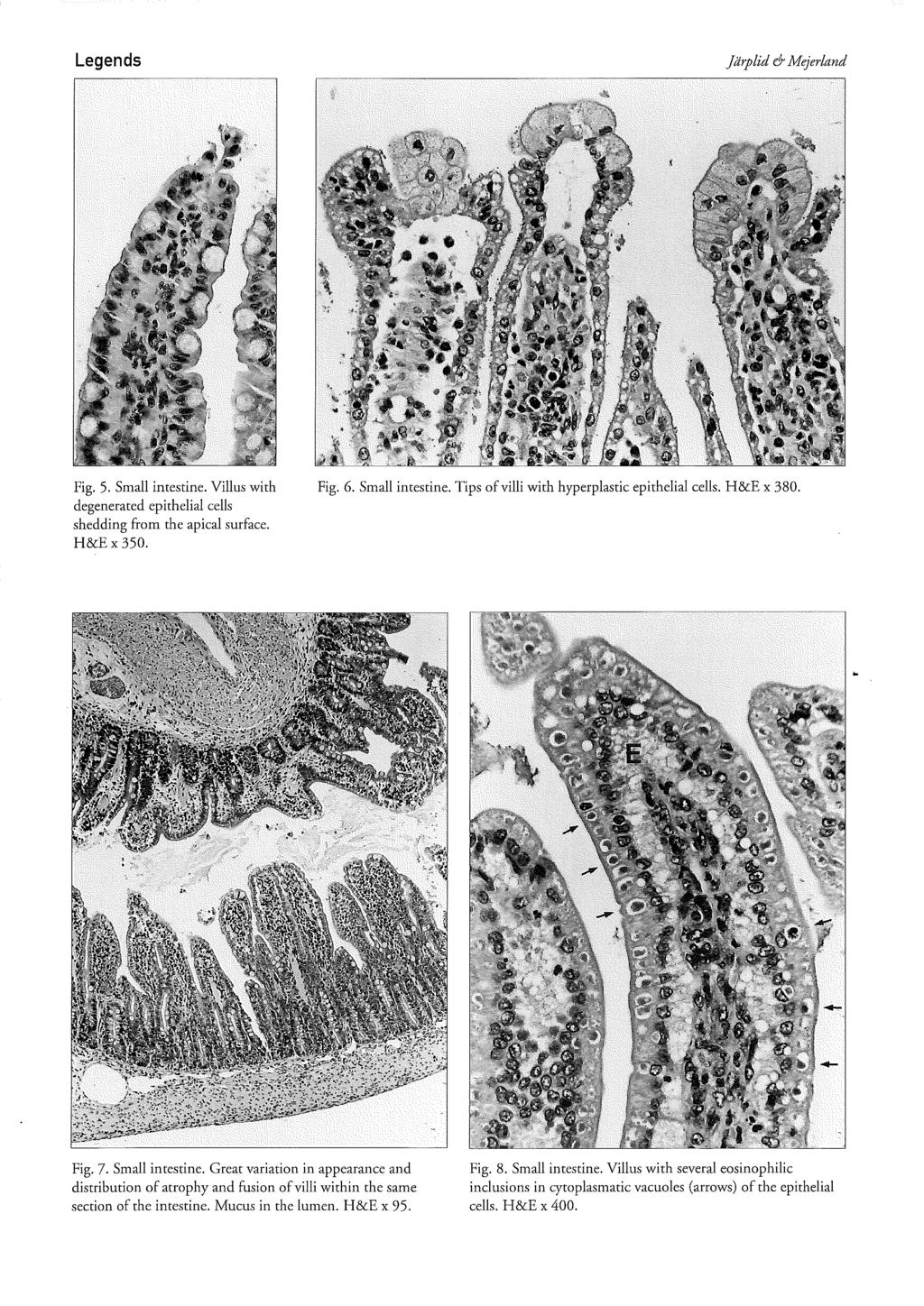 Legends jdrplid e+ Mejerland Fig. 5. Small intestine. Villus with Fig. 6. Small intestine. Tips of villi with hyperplastic epithelial cells. H&E x 380.