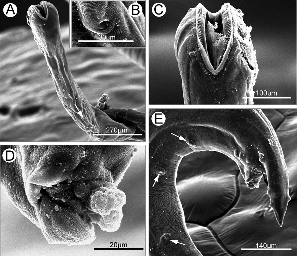714 Zhen Xu et al. Fig. 3. Scanning electron micrographs of Cucullanus hainanensis sp. nov. from Muraenichthys gymnopterus (Bleeker) (Anguilliformes: Ophichthidae) in the South China Sea, male.