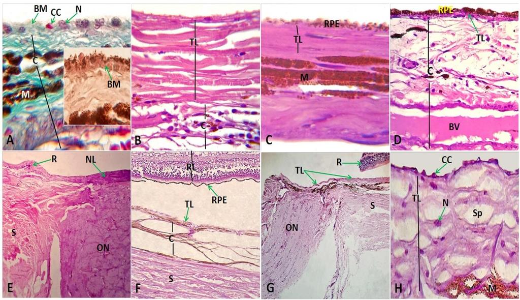 (Onl), Outer plexiform layer (Opl), Inner nuclear layer (Inl), Inner plexiform layer (Ipl), Ganglionic layer (Gl), Brush's Membrane (BM), Melanin granules (M), Blood vessels (Bv), Choriocapillary