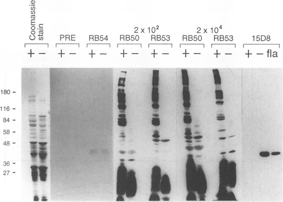 Although there was a marked increase in circulating antibody directed against whole cells and FHA, no increase in antibody against flagella was observed in animals infected with RB5, RB53, or RB54