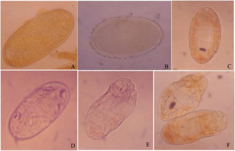 266 Fig. 1: Embryonic development of Dolichotertranychus cocos at different hours of incubation. A. At 0 hour; B. After 11 hour; C. After 23 hour; D. After 35 hour; E. After 47 hour; F. After 59 hour.