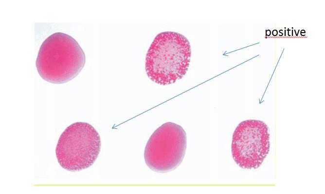 Brucella test GD Rose Bengal simple, rapid slide-type agglutination assay performed with a stained Brucella abortus suspension (ph 3.6 3.